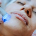 What is the most popular aesthetic procedure?