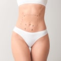 Understanding Mini Tummy Tucks: A Comprehensive Guide to Body Contouring