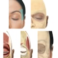 Temple Filler in Chiswick: Restoring Balance Without Surgery