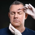 Bell's Palsy Recovery: How Aesthetic Medicine Can Help