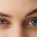 Lifting the Standard: Why Brow Lifts Are the Future of Natural Aesthetics