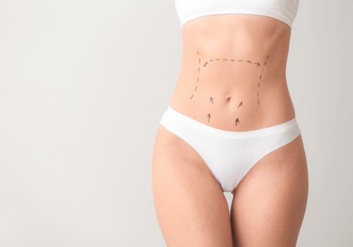 Understanding Mini Tummy Tucks: A Comprehensive Guide to Body Contouring