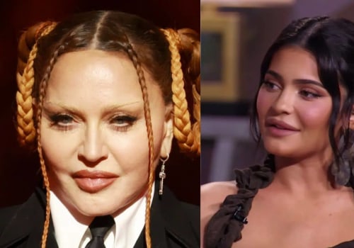 Do fillers disappear over time?