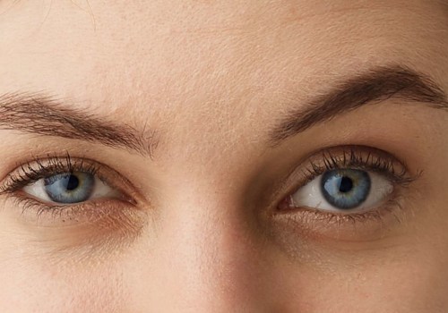 Lifting the Standard: Why Brow Lifts Are the Future of Natural Aesthetics